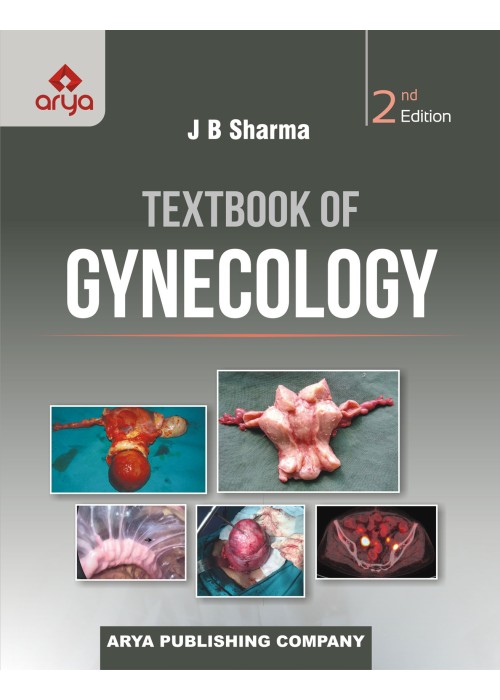 Textbook of Gynecology